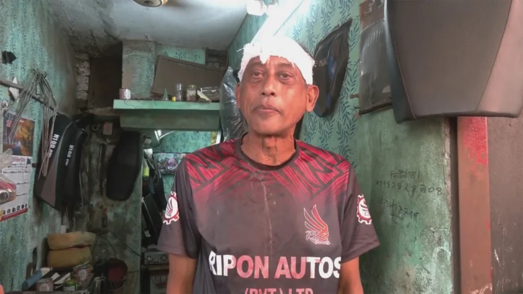 বাড়ির সামনে হামলার শিকার অভিনেতা সমু চৌধুরী, মাথায় ৪ সেলাই